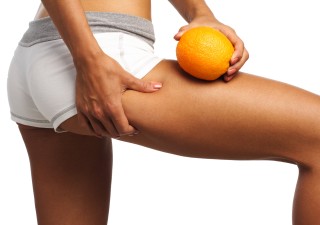 How To Treat Skin With Rashes? Truth About Cellulite and Rashes