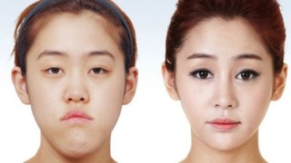 Tips On Selecting A Plastic Surgery Clinic In Korea