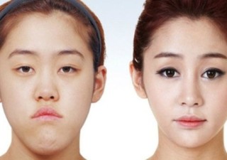 Tips On Selecting A Plastic Surgery Clinic In Korea