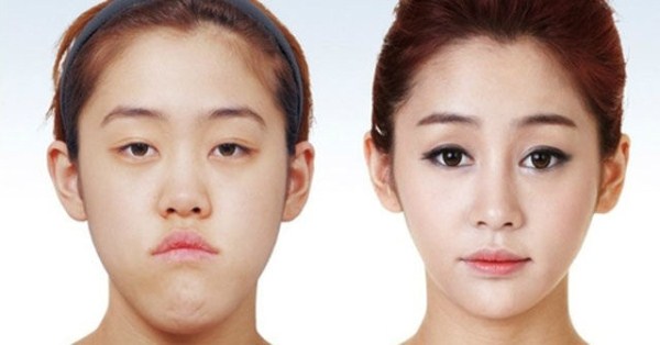 Tips On Selecting A Plastic Surgery Clinic In Korea