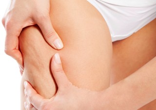 5 Effective Tips To Reduce Cellulite