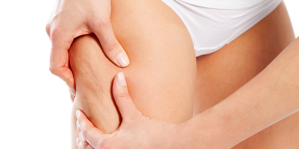 5 Effective Tips To Reduce Cellulite