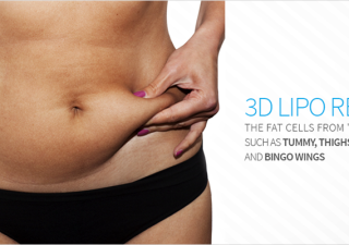 Rejuvenate Your Shape With 3d Liposuction Procedure