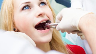 Tooth Extraction: When And Why Is It Done?