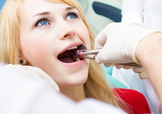 Tooth Extraction: When And Why Is It Done?