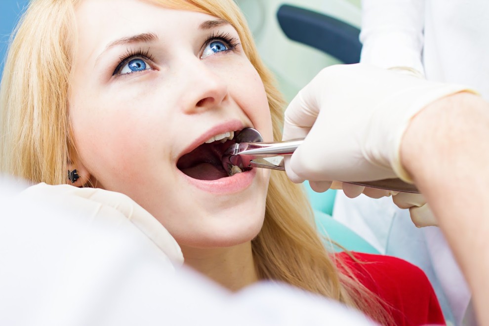 Tooth Extraction: When And Why Is It Done?