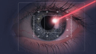 Great Tips About Laser Eye Surgery