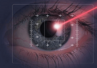 Great Tips About Laser Eye Surgery