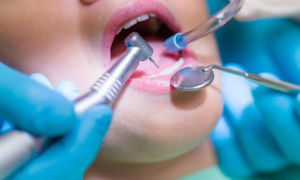 How To Prepare For Oral Surgery and All The Health Benefits