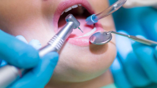 How To Prepare For Oral Surgery and All The Health Benefits