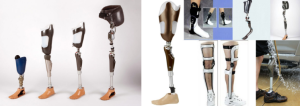 All You Need To Know About Prosthetic Limbs