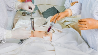 World Class Transplant Facility Ensuring Success