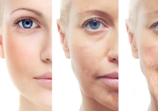 Laser Skin Rejuvenation: Top 4 Myths That Need To Die